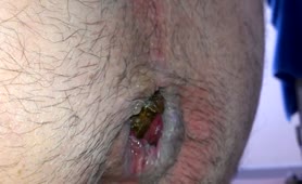 Hard turd from his hairy ass