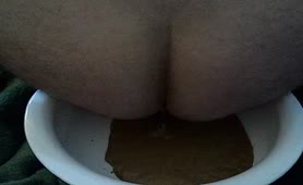 Brown diarheea in a urinal