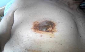 Smearing poop on entire ass
